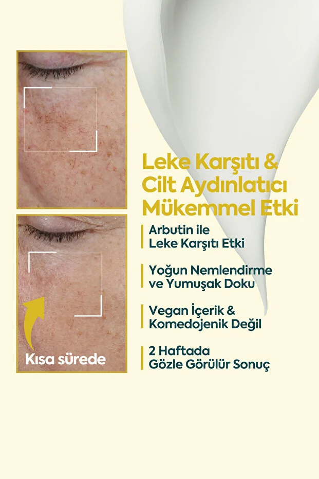 Clasy Care, Face Up Skin, Aydınlatıcı Leke Kremi Kremi - 40 ml