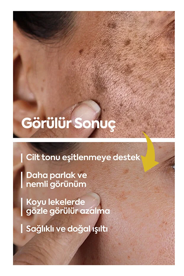 Clasy Care, Face Up Skin, Aydınlatıcı Leke Kremi Kremi - 40 ml