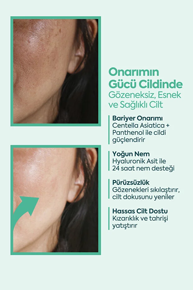 Clasy Care, Face Up Skin, Gözenek Sıkılaştırıcı, Onarıcı, Kırışıklık Karşıtı Cilt Kremi - 40ml