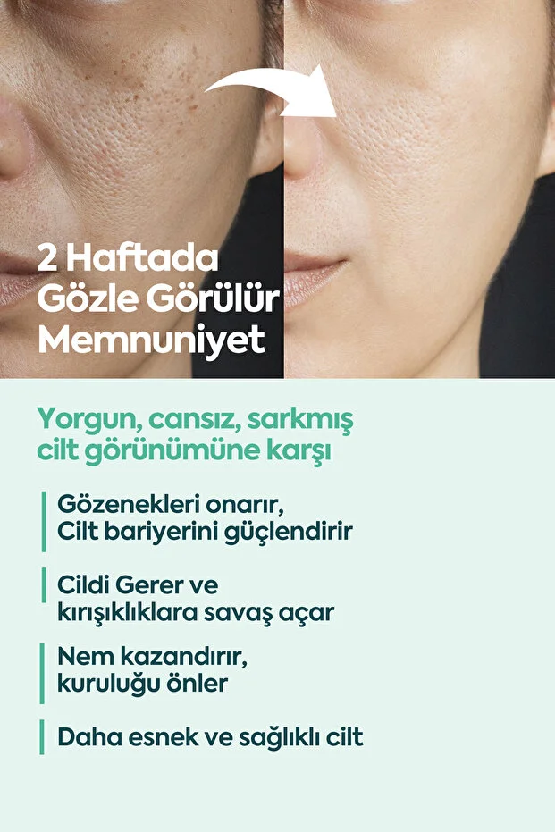 Clasy Care, Face Up Skin, Gözenek Sıkılaştırıcı, Onarıcı, Kırışıklık Karşıtı Cilt Kremi - 40ml