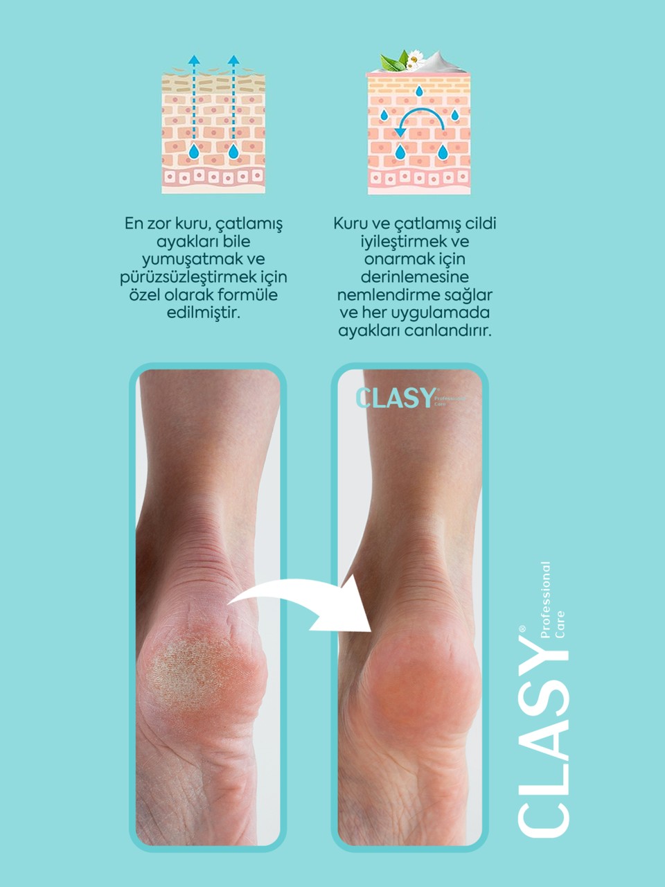 Clasy Care, Topuk Çatlak ve Ayak Bakım Kremi -100 ml