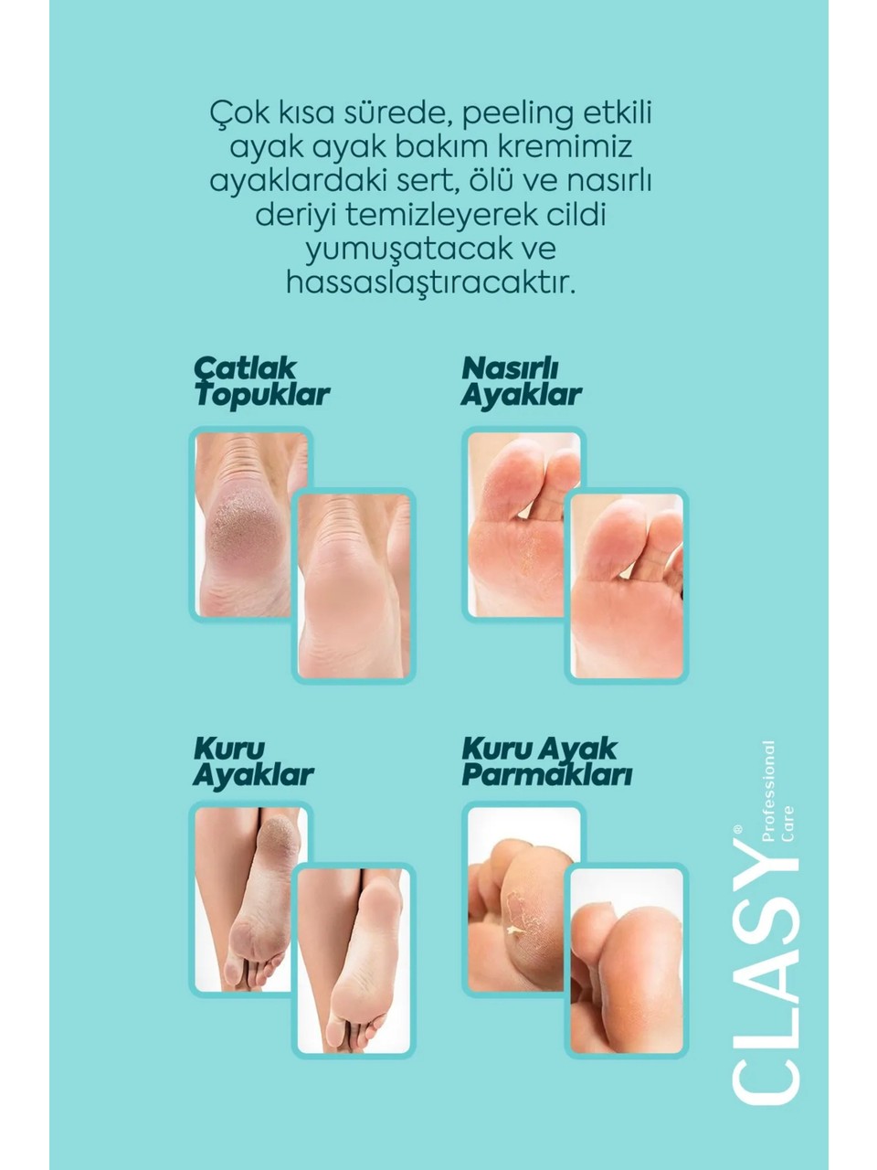 Clasy Care, Topuk Çatlak ve Ayak Bakım Kremi -100 ml