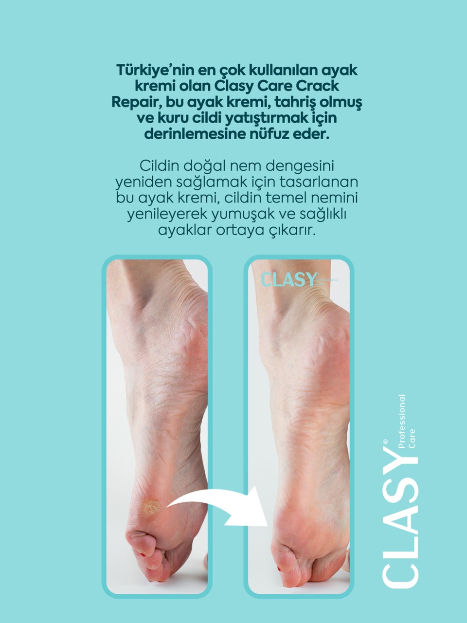 Clasy Care, Topuk Çatlak ve Ayak Bakım Kremi -100 ml