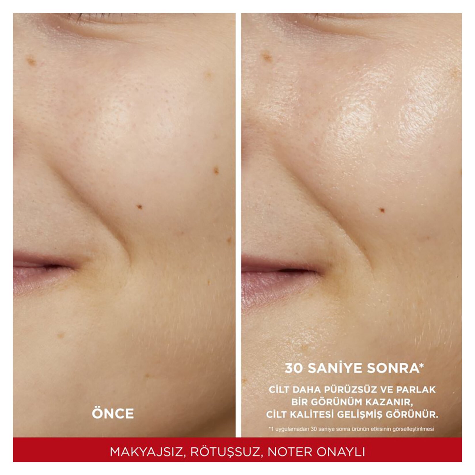 L’Oréal Paris, Revitalift %5 Saf Glikolik Asit, Peeling Etkili Tonik - 180 ml